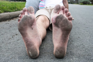 Palmore's feet after a run.